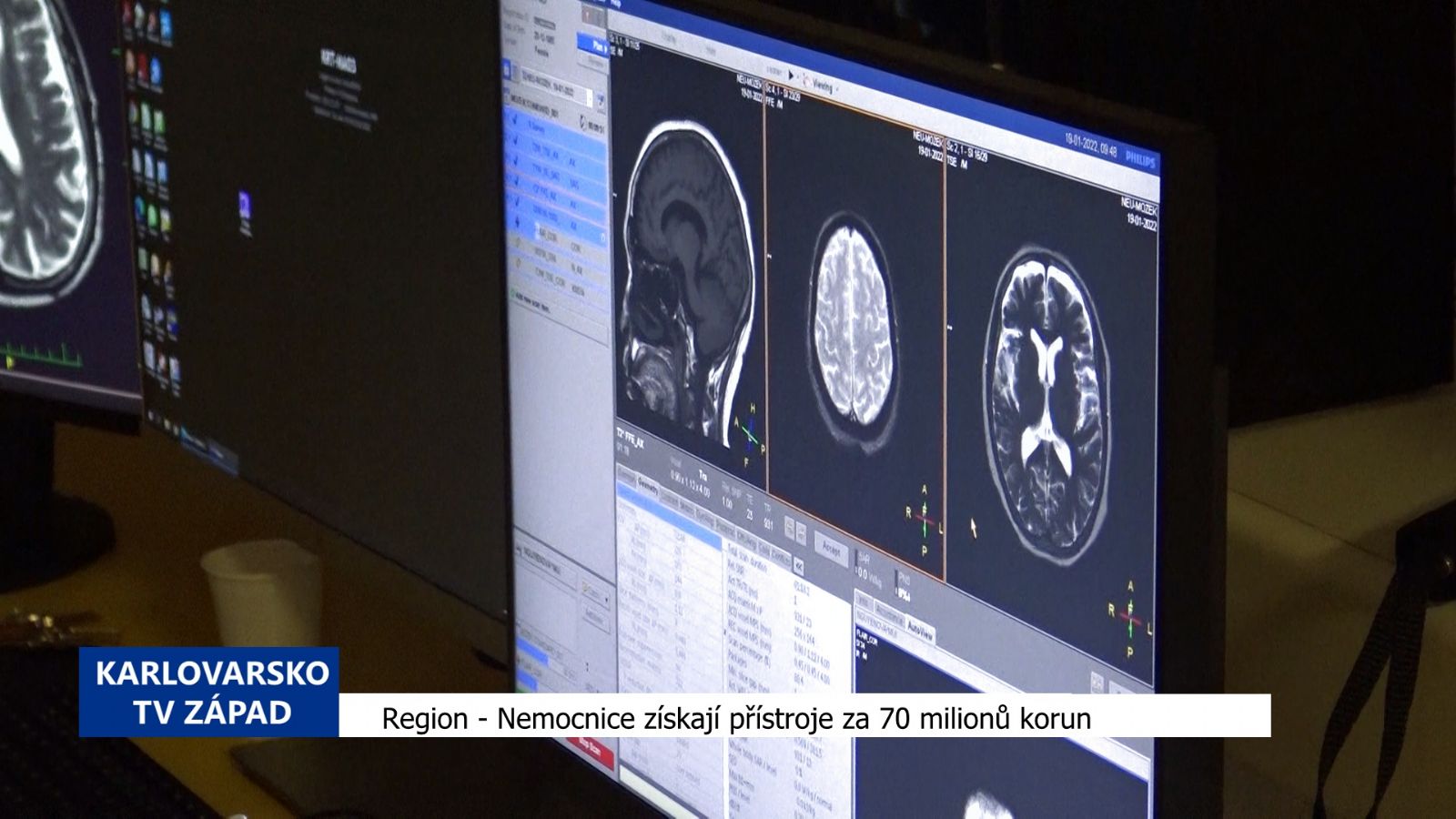Region: Nemocnice získají přístroje za 70 milionů (TV Západ)