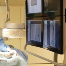 Region: Kraj pracuje na získání dotace pro rozvoj onkologické péče v regionu