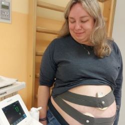 Sokolov: Porodnice má k dispozici nové CTG pásy