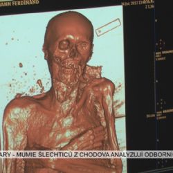 Karlovy Vary: Mumie šlechticů z Chodova analyzují odborníci (TV Západ)