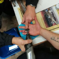 Kraslicko: Hasiči pomohli odstranit prstýnek z oteklého prstu