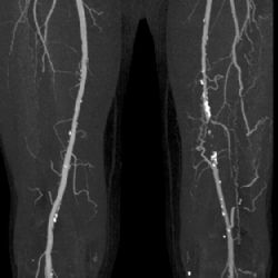 Ostrov: Nemocnice investovala 8 milionů do nového CT zařízení
