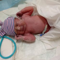 Ostrov: Operátorka z linky 155 pomohla na svět holčičce